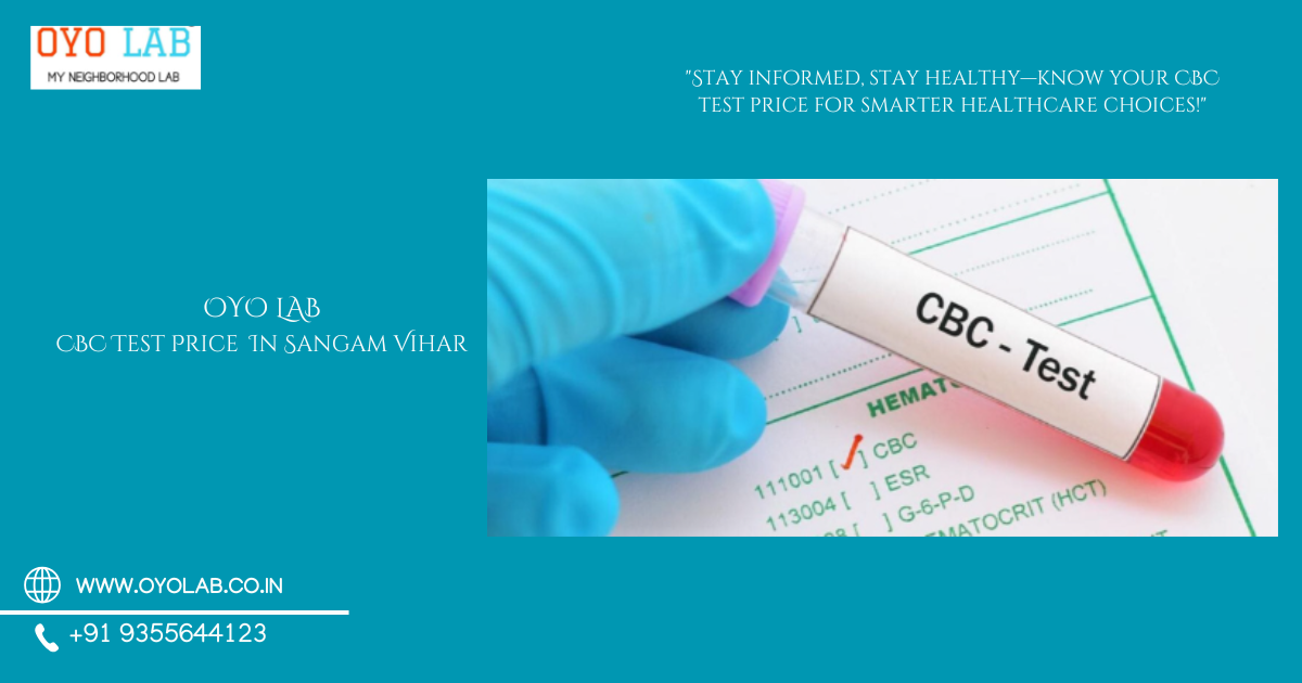 CBC Test Price In Sangam Vihar