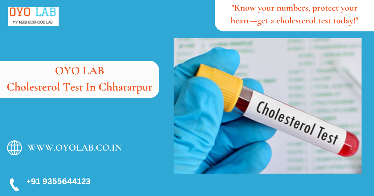 Cholesterol Test In Chhatarpur