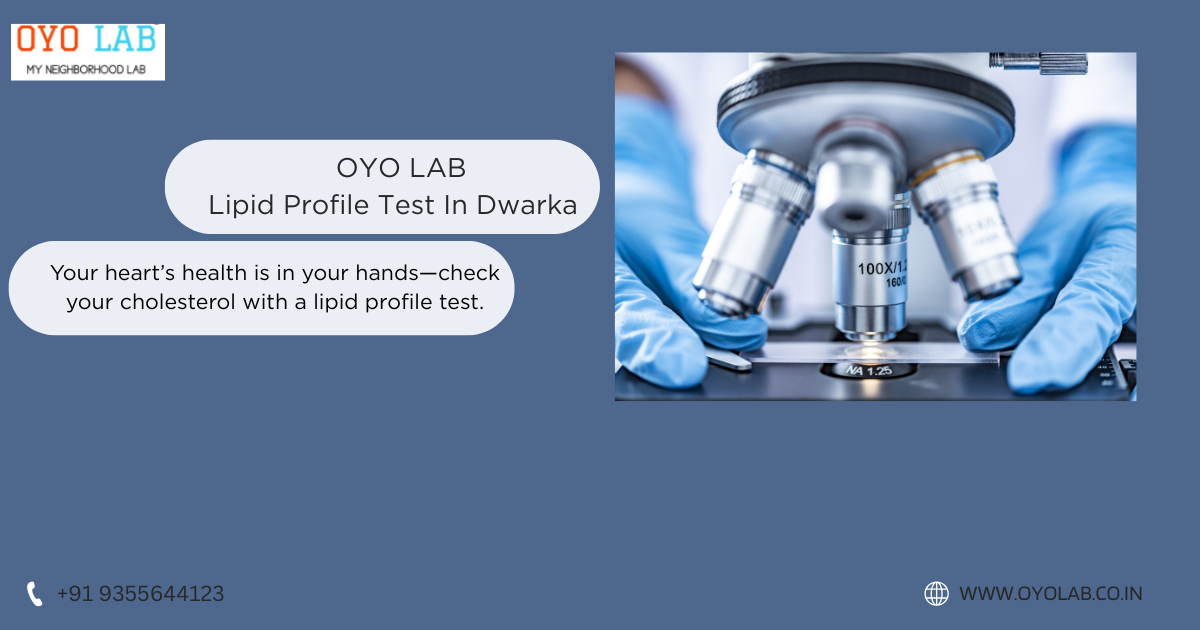 Lipid Profile Test In Dwarka