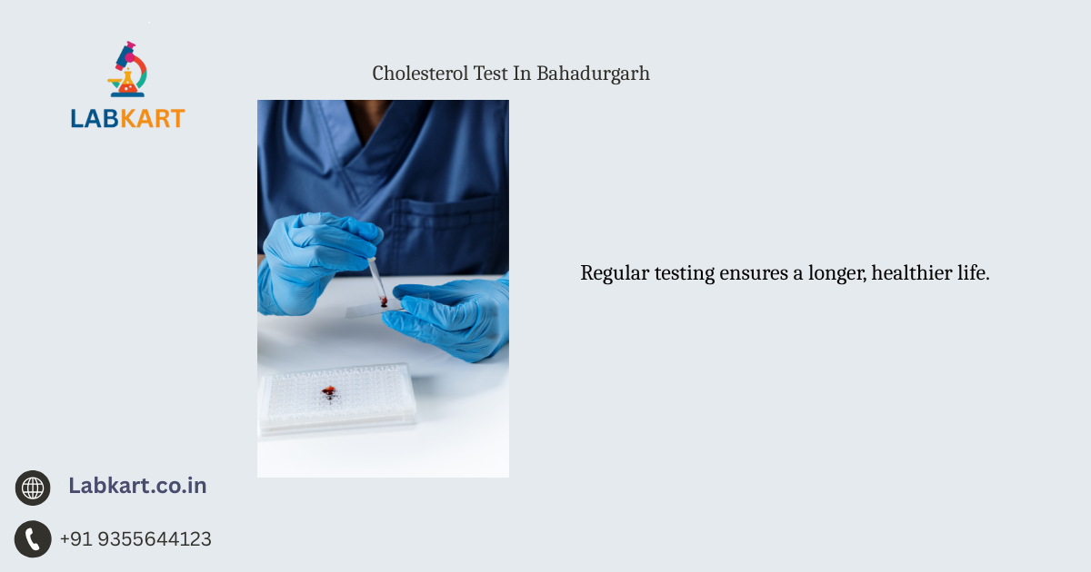 Featured image of blog: Cholesterol Test In Bahadurgarh