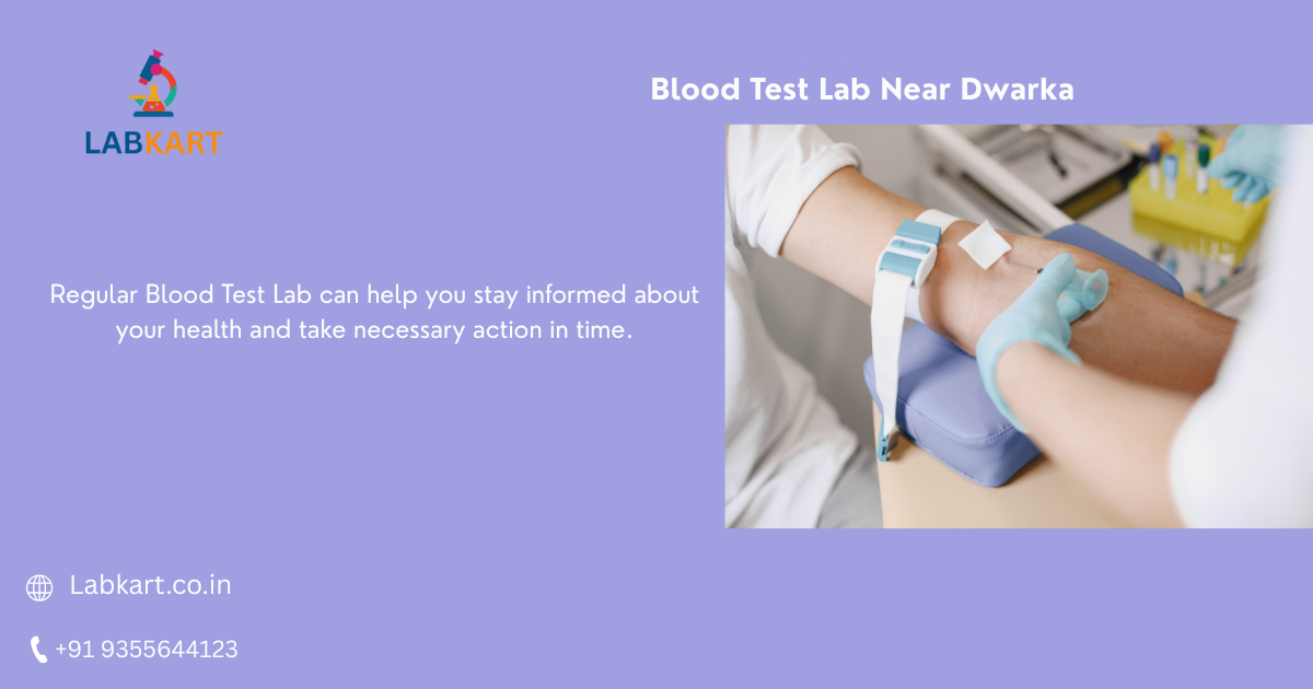 Featured image of blog: Blood Test Lab Near Dwarka