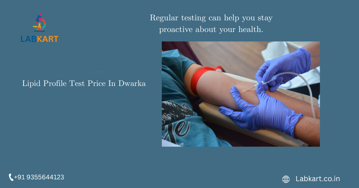 Featured image of blog: Lipid Profile Test Price In Dwarka