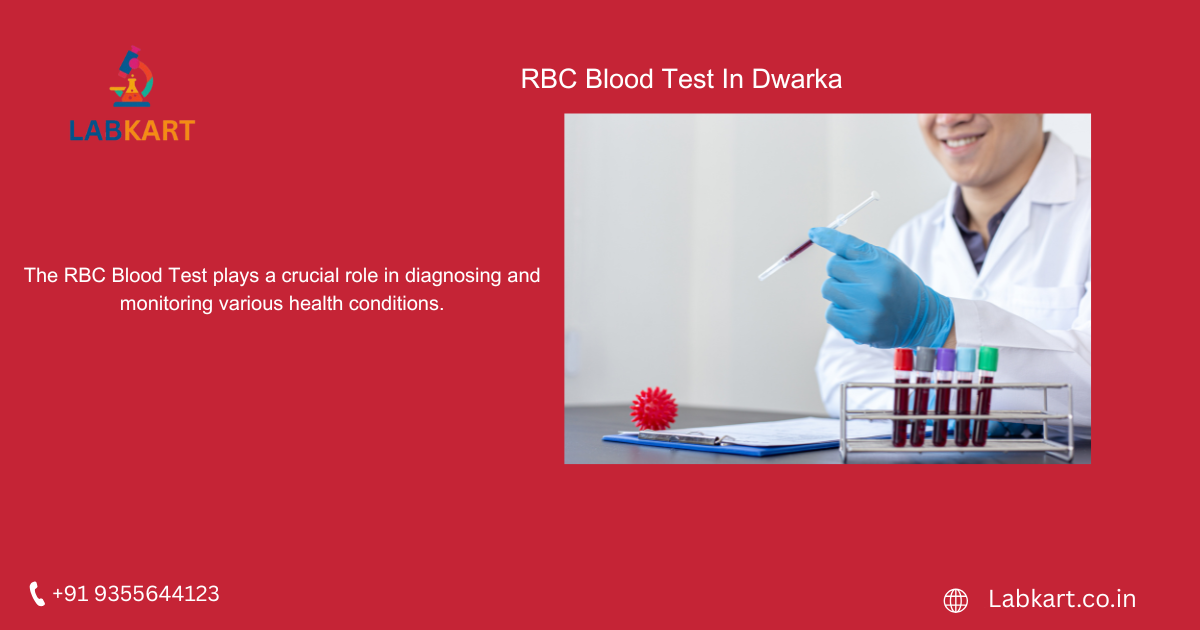Featured image of blog: RBC Blood Test In Dwarka