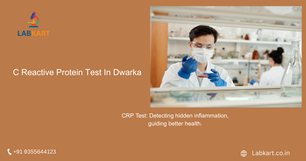 Featured image of blog: C Reactive Protein Test In Dwarka