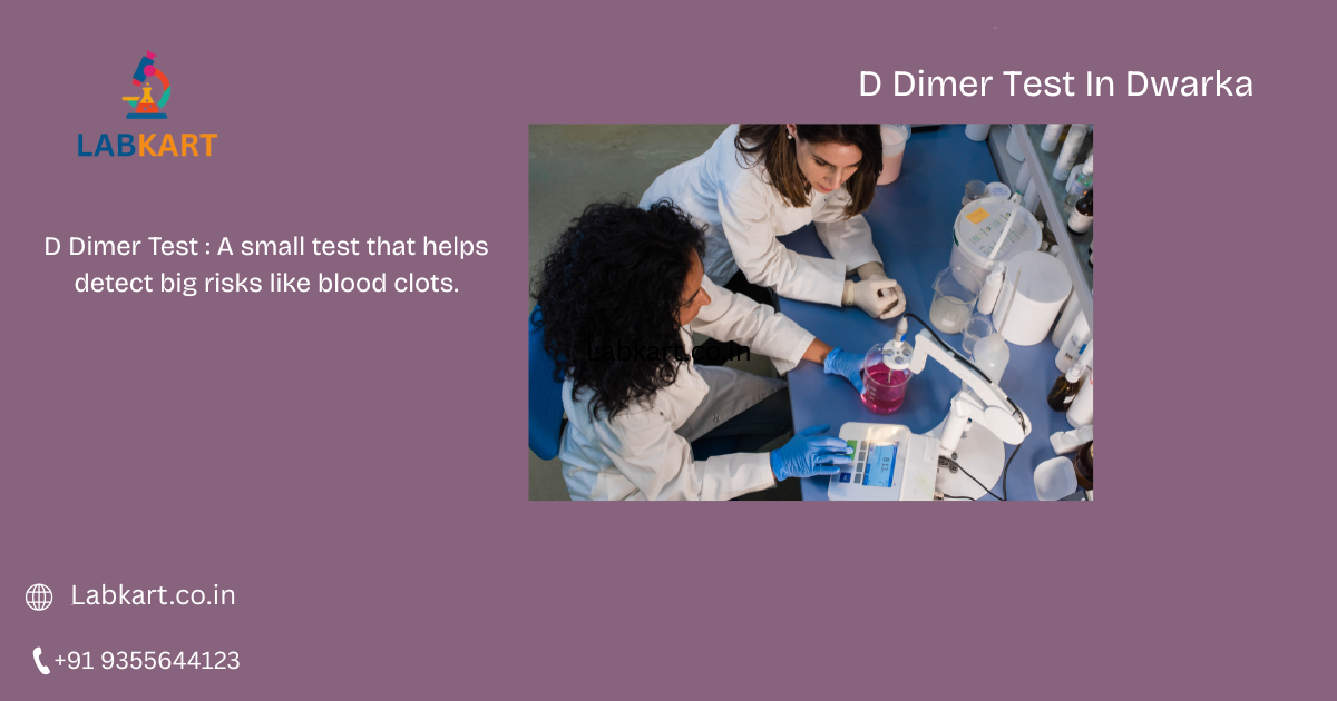 Featured image of blog: D Dimer Test In Dwarka