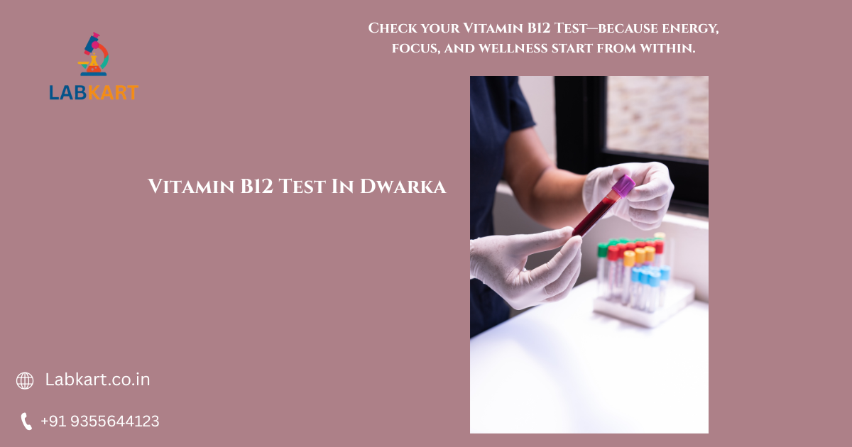 Featured image of blog: Vitamin B12 Test In Dwarka