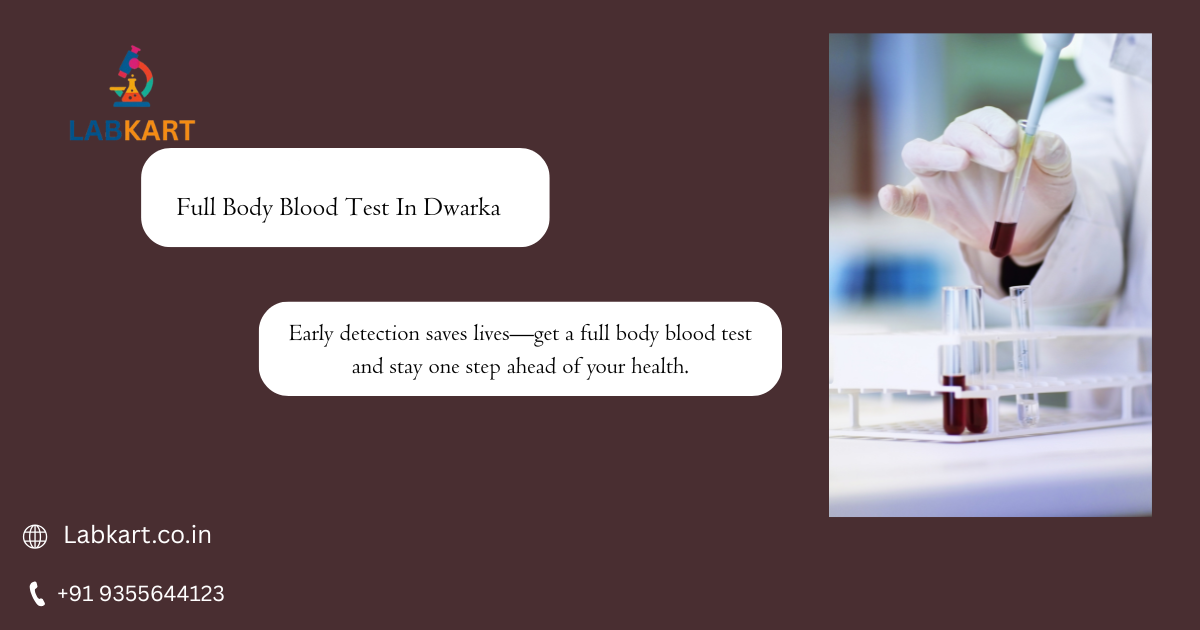 Featured image of blog: Full Body Blood Test In Dwarka