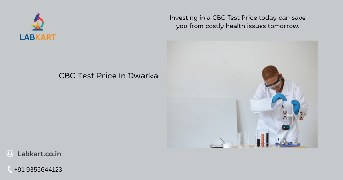 Featured image of blog: CBC Test Price In Dwarka