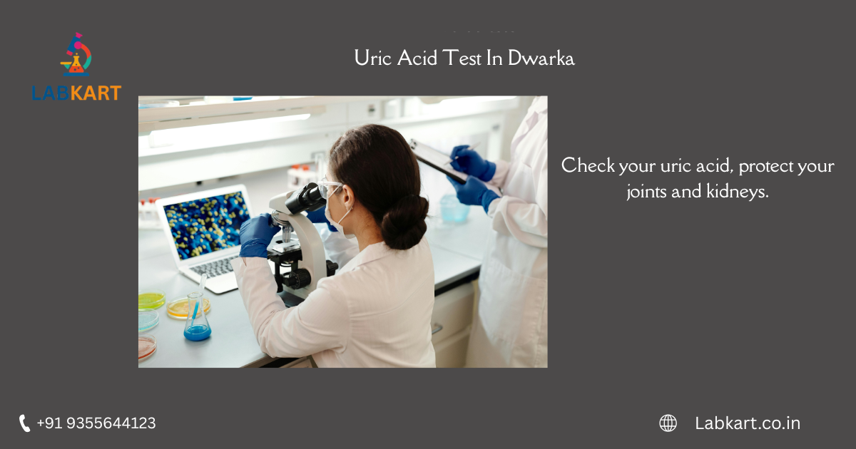 Featured image of blog: Uric Acid Test In Dwarka