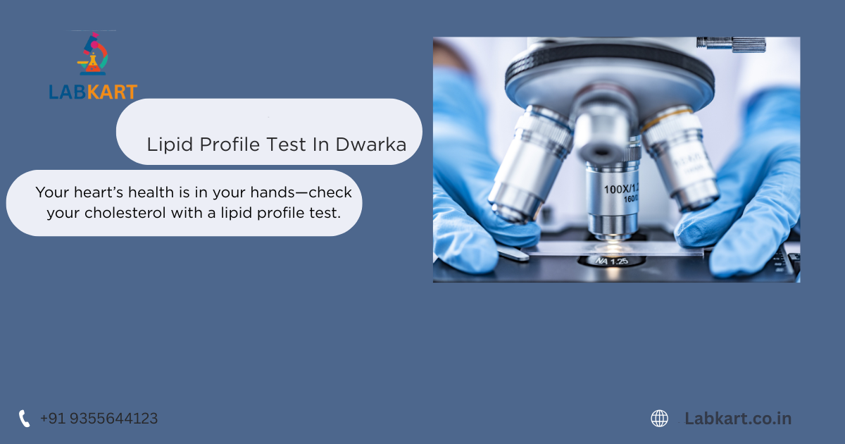 Featured image of blog: Lipid Profile Test In Dwarka