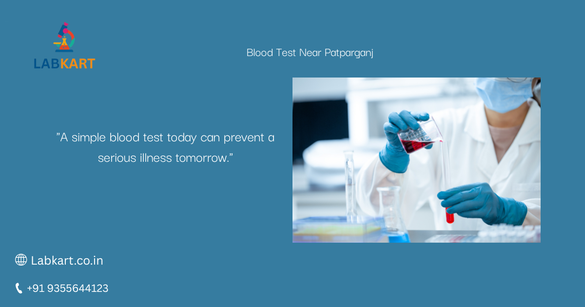 Featured image of blog: Blood Test Near Patparganj