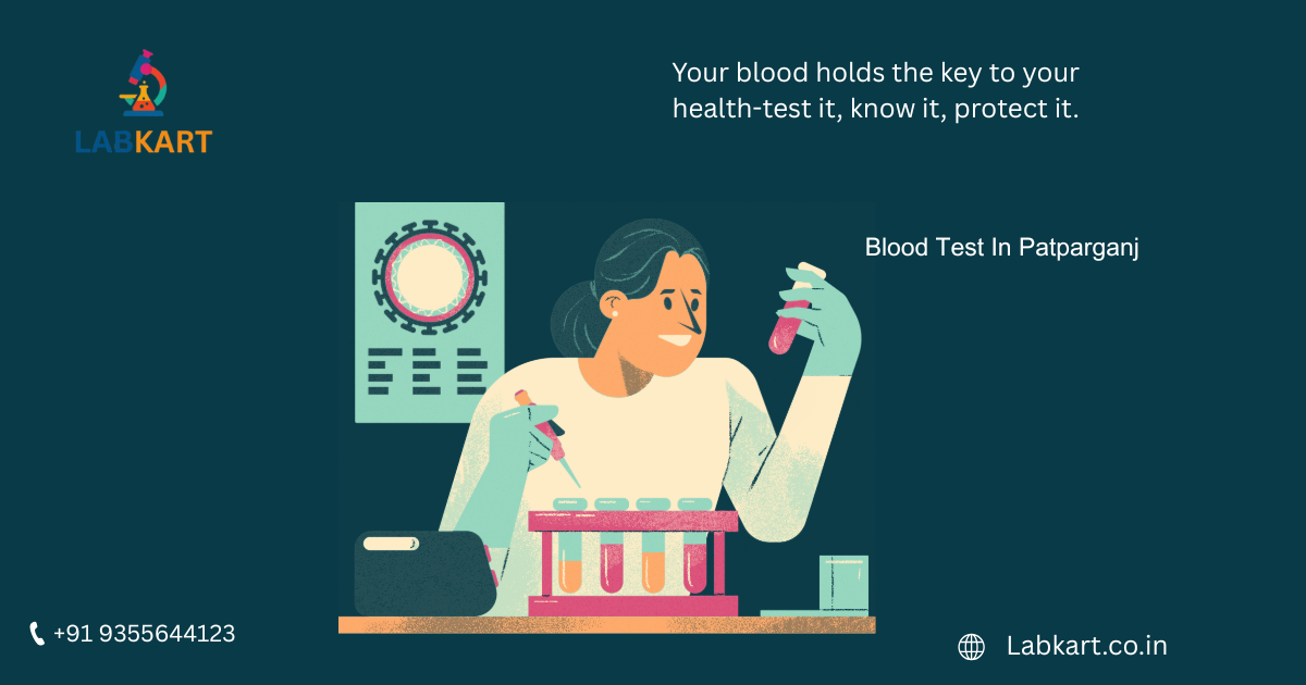 Featured image of blog: Blood Test In Patparganj