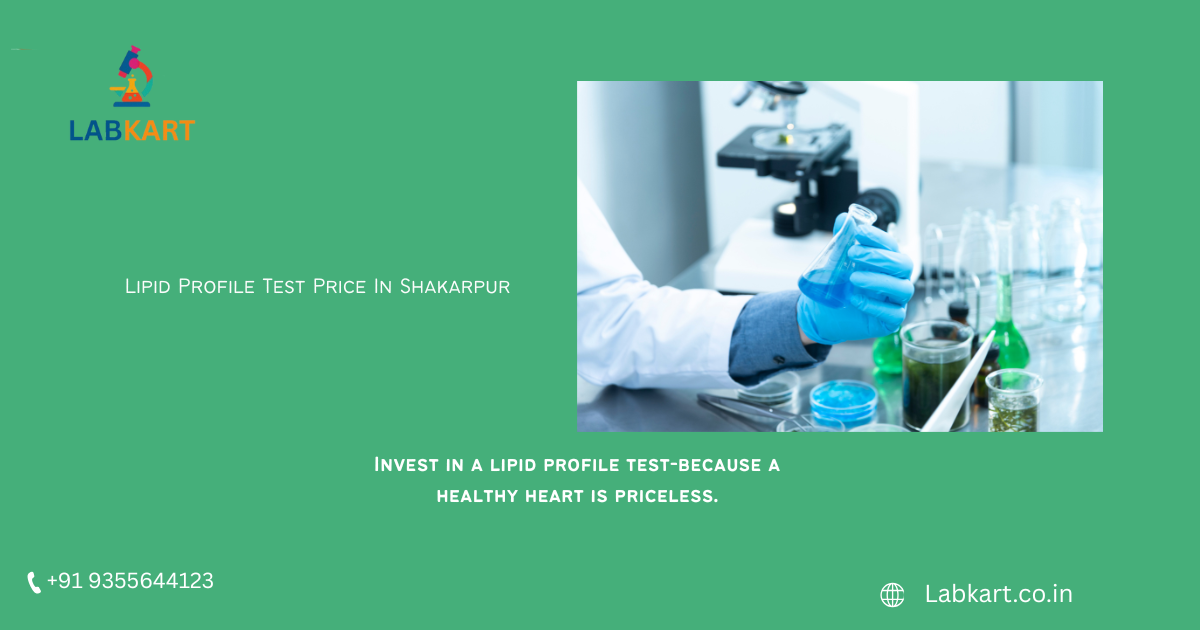 Featured image of blog: Lipid Profile Test Price In Shakarpur