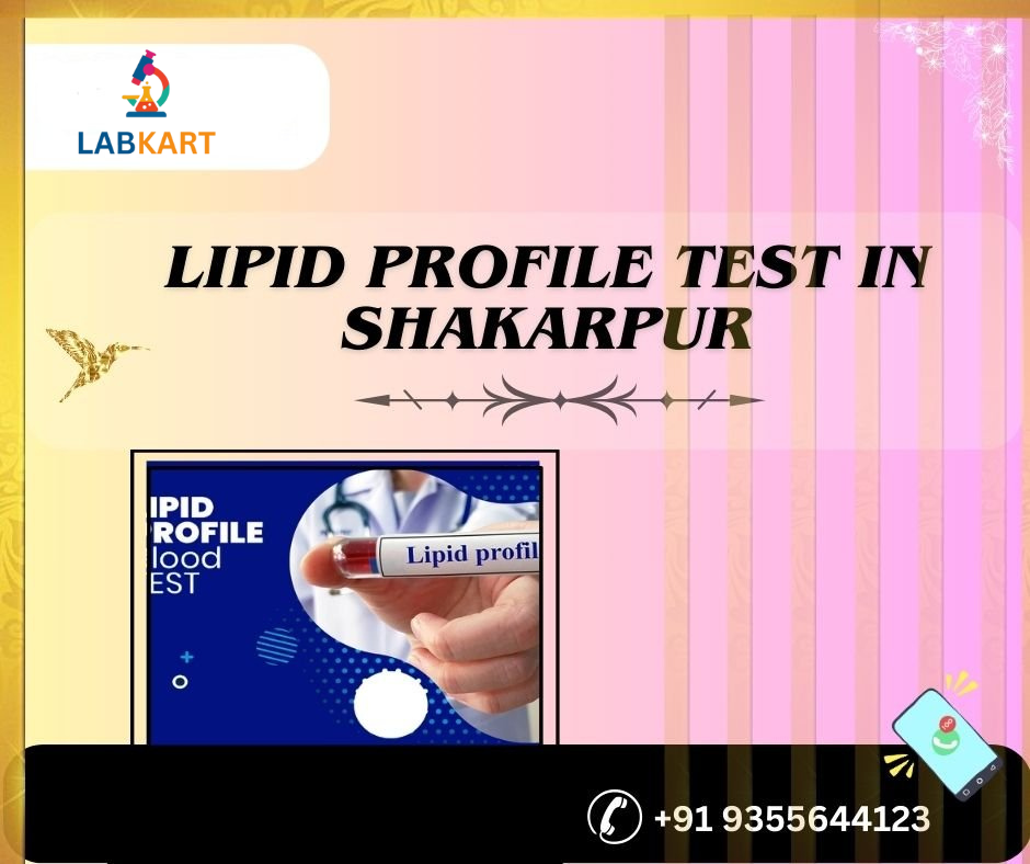 Featured image of blog: lipid profile test in shakarpur