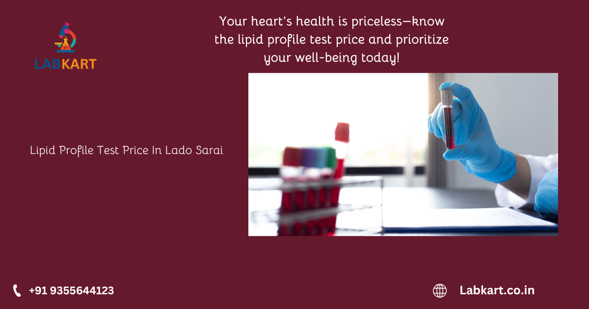 Featured image of blog: Lipid Profile Test Price In Lado Sarai