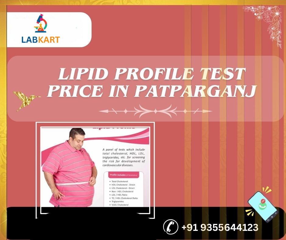 Featured image of blog: lipid profile test price in patparganj