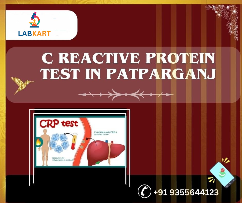 Featured image of blog: c reactive protein test in patparganj