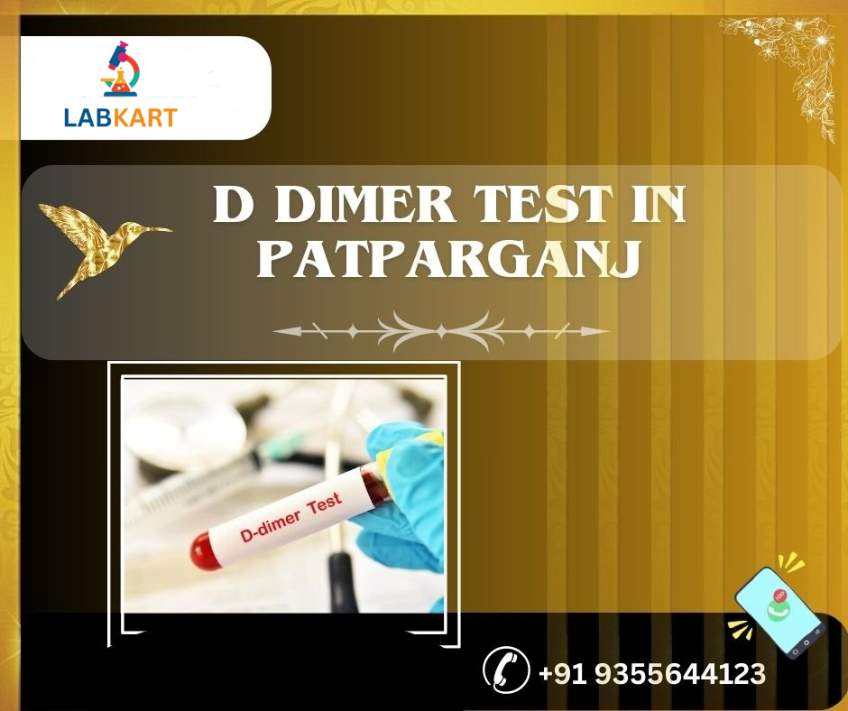 Featured image of blog: D dimer test in patparganj