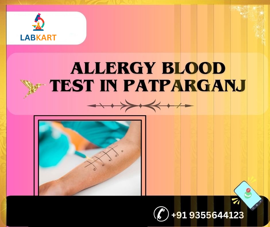 Featured image of blog: allergy blood test in patparganj
