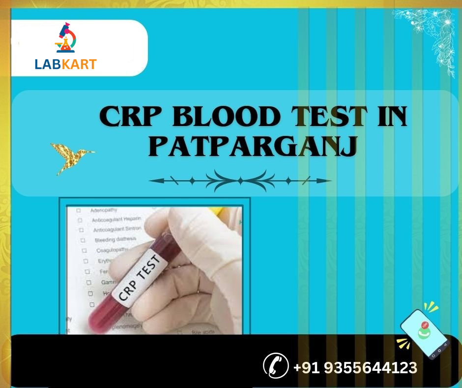 Featured image of blog: crp blood test in patparganj