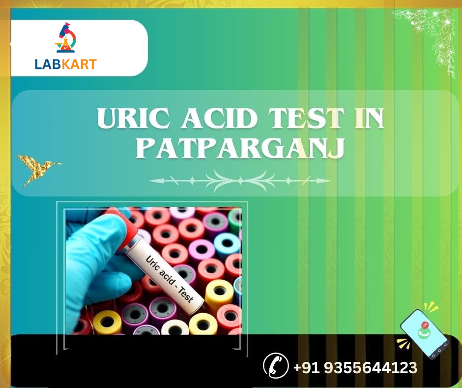 Featured image of blog: uric acid test in patparganj