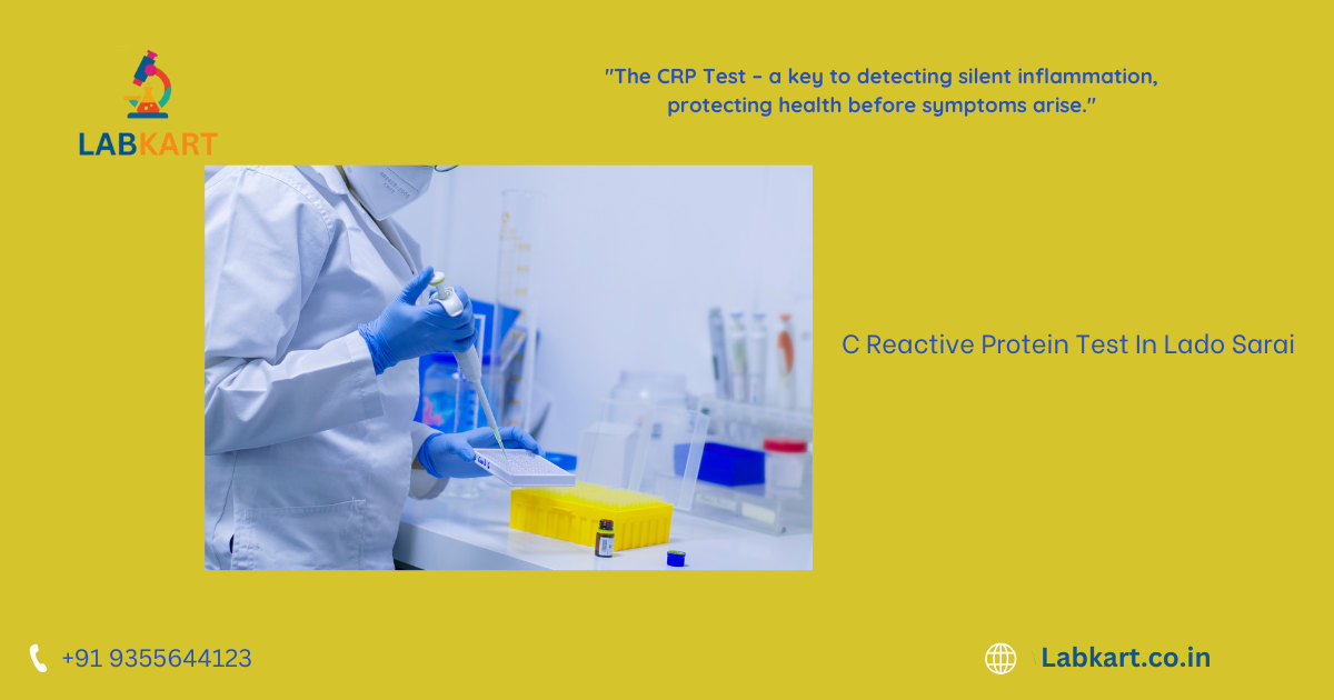 Featured image of blog: C Reactive Protein Test In Lado Sarai