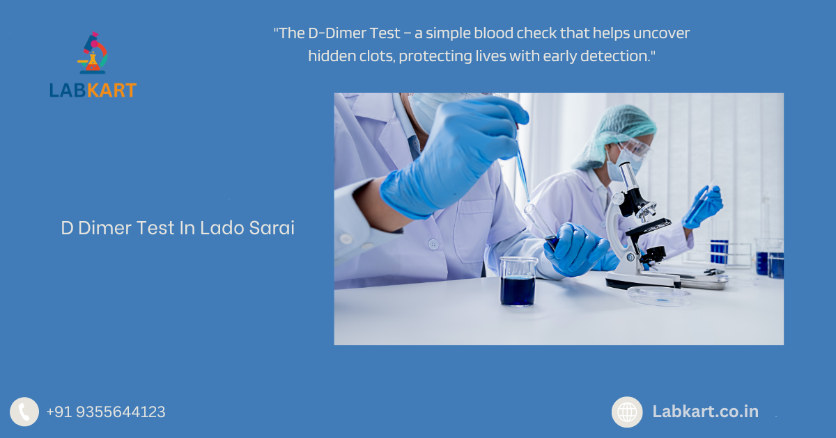 Featured image of blog: D Dimer Test In Lado Sarai