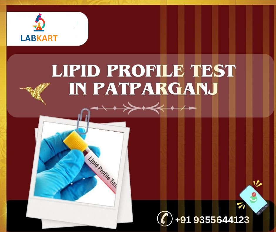 Featured image of blog: lipid profile test in patparganj