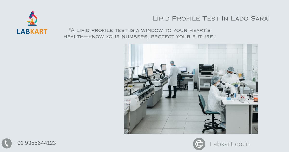 Featured image of blog: Lipid Profile Test In Lado Sarai