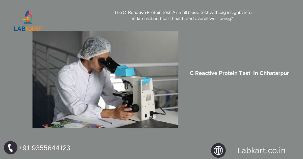 Featured image of blog: C Reactive Protein Test In Chhatarpur