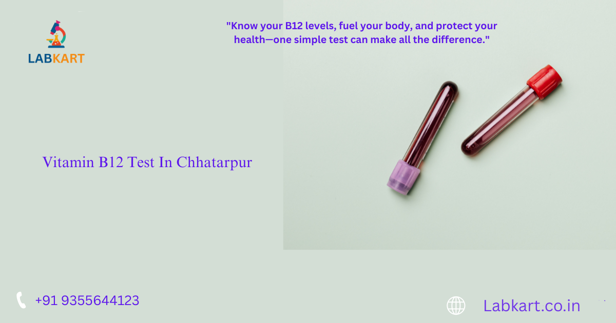 Featured image of blog: Vitamin B12 Test In Chhatarpur
