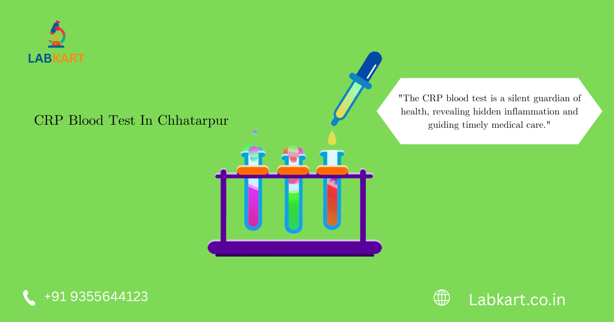 Featured image of blog: CRP Blood Test In Chhatarpur