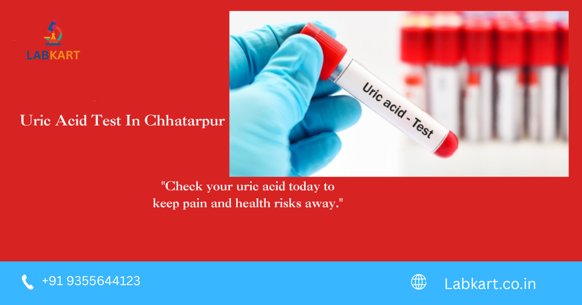 Featured image of blog: Uric Acid Test In Chhatarpur