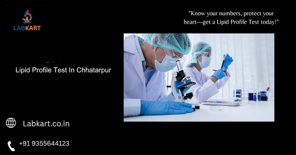 Featured image of blog: Lipid Profile Test In Chhatarpur