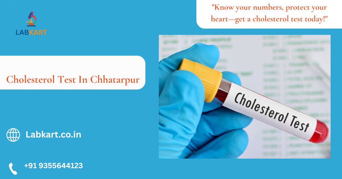 Featured image of blog: Cholesterol Test In Chhatarpur