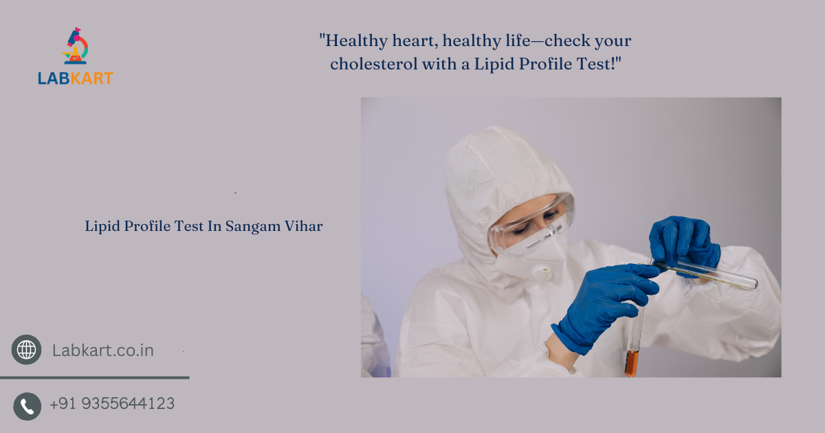Featured image of blog: Lipid Profile Test In Sangam Vihar