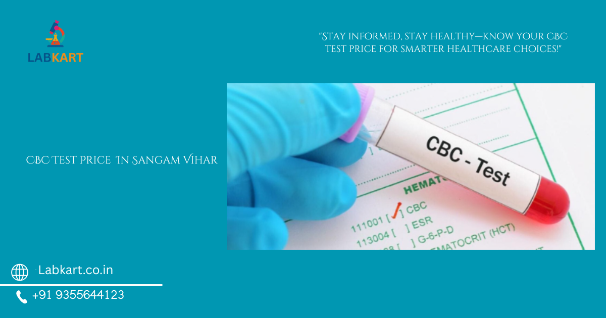 Featured image of blog: CBC Test Price In Sangam Vihar