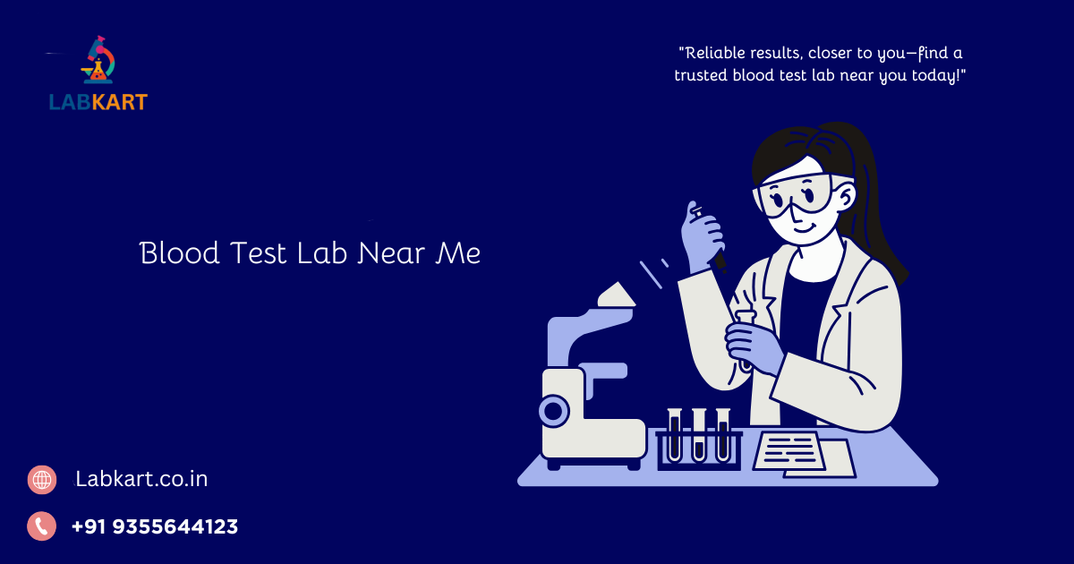 Featured image of blog: Blood Test Lab Near Me