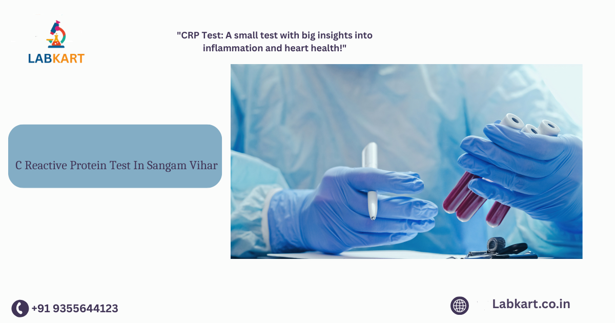 Featured image of blog: C Reactive Protein Test In Sangam Vihar