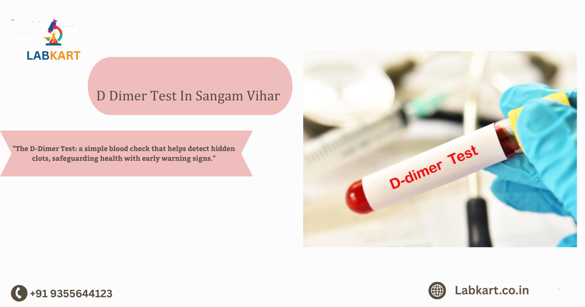 Featured image of blog: D Dimer Test In Sangam Vihar