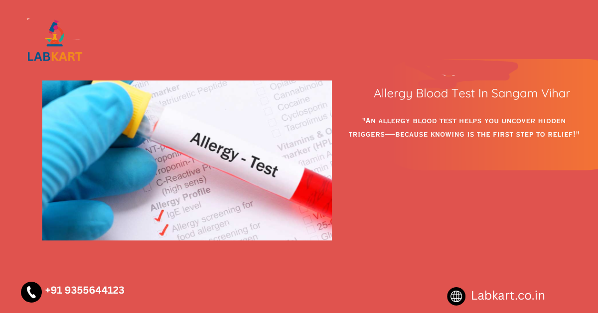 Featured image of blog: Allergy Blood Test In Sangam Vihar