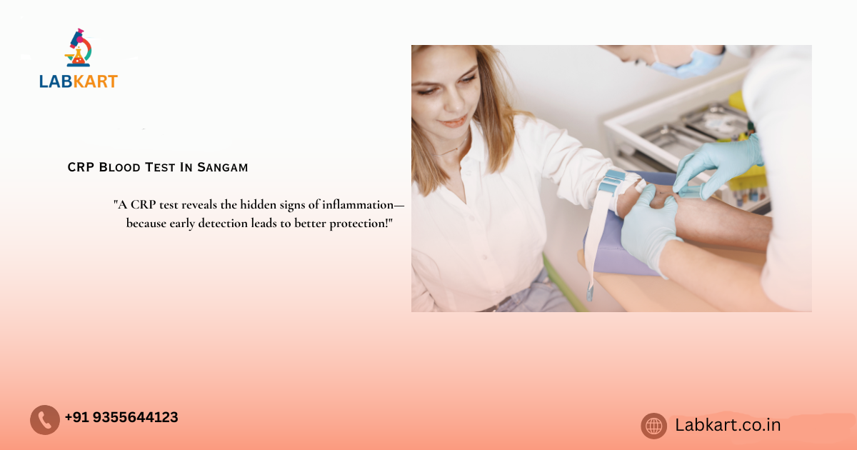 Featured image of blog: CRP Blood Test In Sangam Vihar