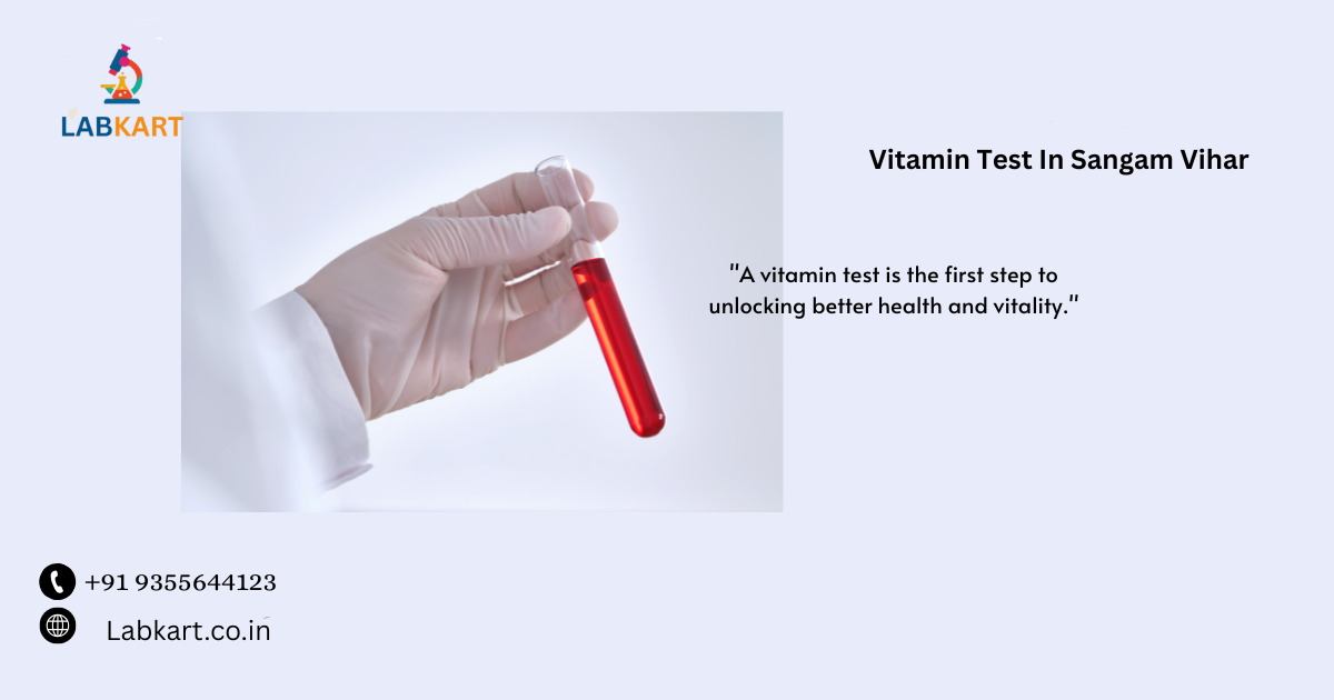 Featured image of blog: Vitamin Test In Sangam Vihar