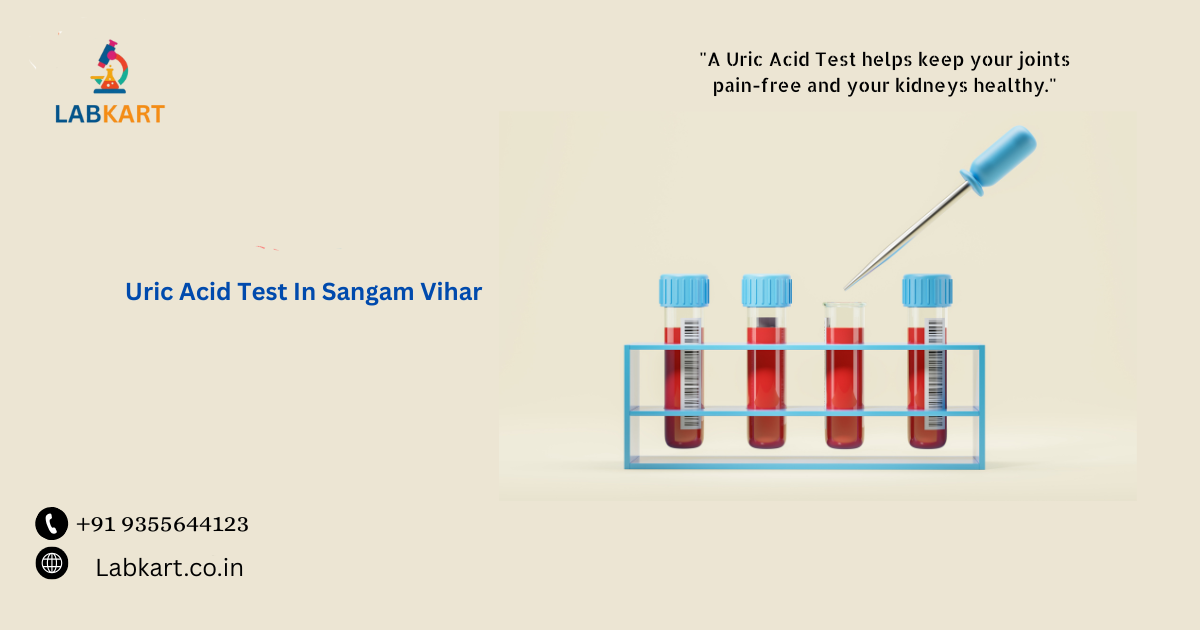 Featured image of blog: Uric Acid Test In Sangam Vihar