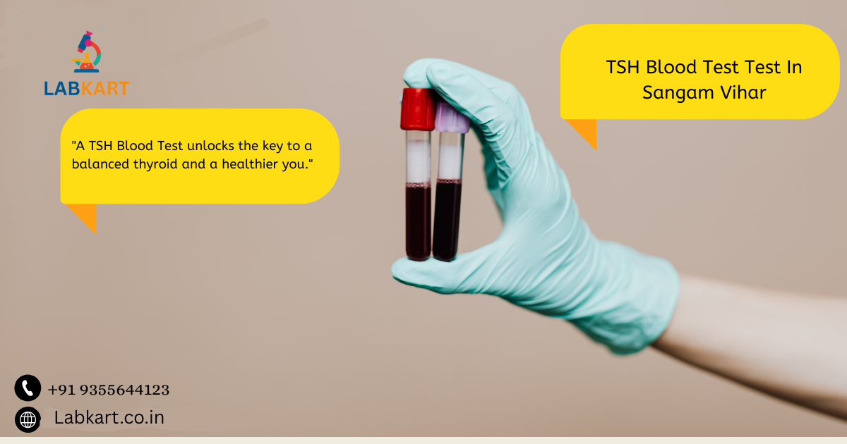 Featured image of blog: TSH Blood Test In Sangam Vihar