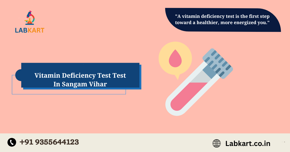 Featured image of blog: Vitamin Deficiency Test In Sangam Vihar