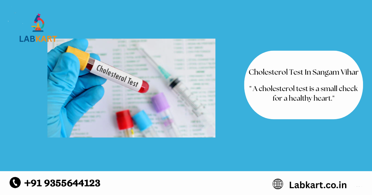 Featured image of blog: Cholesterol Test In Sangam Vihar