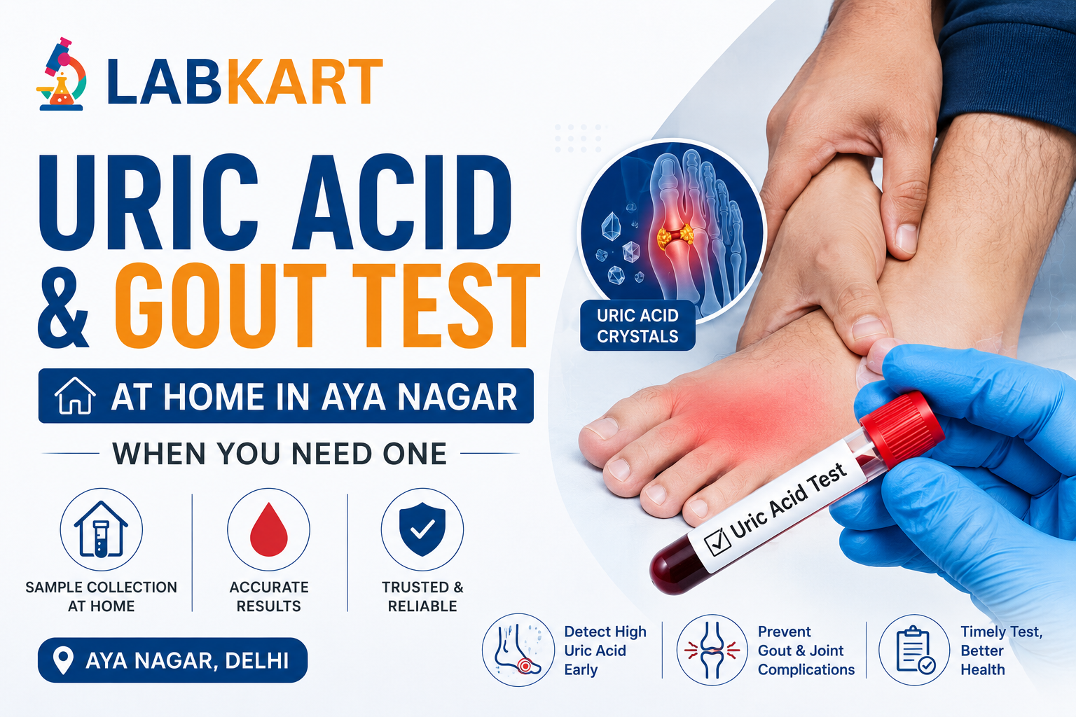 Uric Acid & Gout Test at Home in Aya Nagar: When You Need One