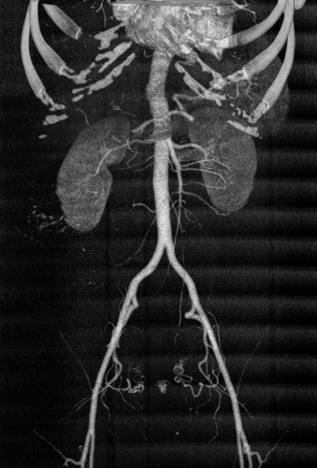 Lab test image of CT Renal Angiography