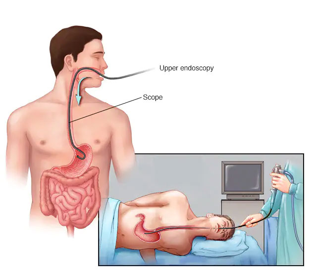 Lab test image of Endoscopy